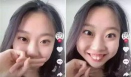 河南都市爆料整牙案件最新,整牙案件引发社会关注，真相究竟如何？